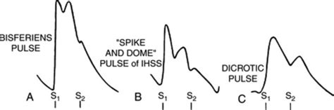 spike and dome|spike and dome pulse.